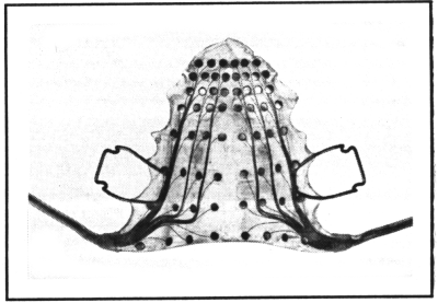 Photograph of an EPG palate